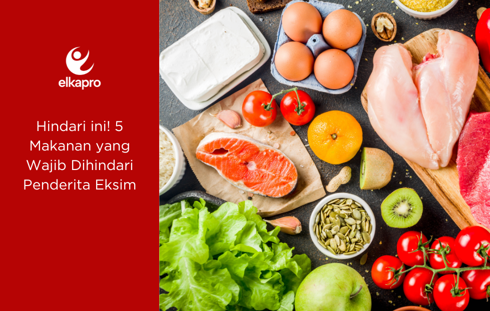 Hindari ini! 5 Makanan yang Wajib Dihindari Penderita Eksim