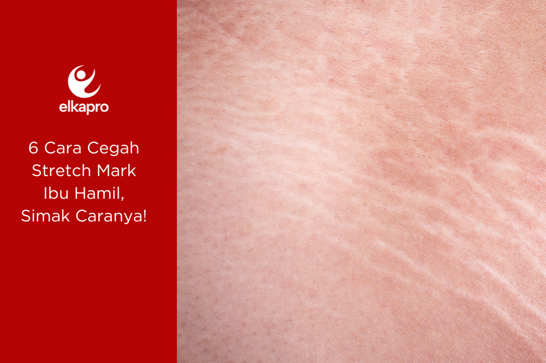 6 Cara Cegah Stretch Mark Ibu Hamil, Simak Caranya!